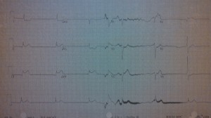 ekg2