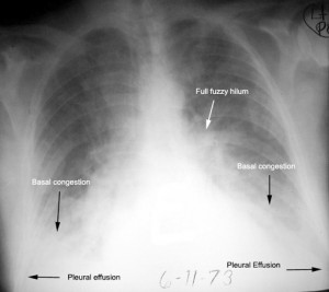 cxr