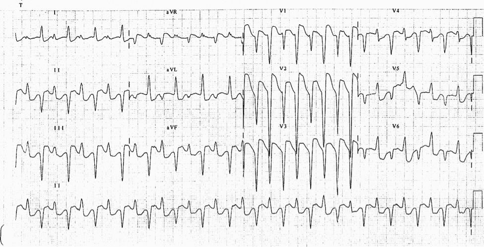 mr07292014p1