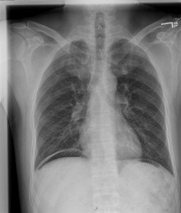 cxr