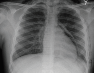 cxr