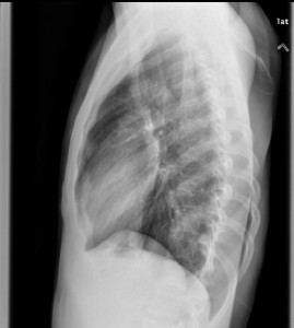 6-15 xray lat