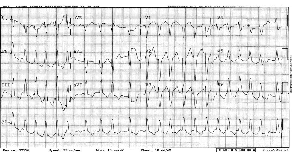 Rhythm Nation: Case 4 - County EM