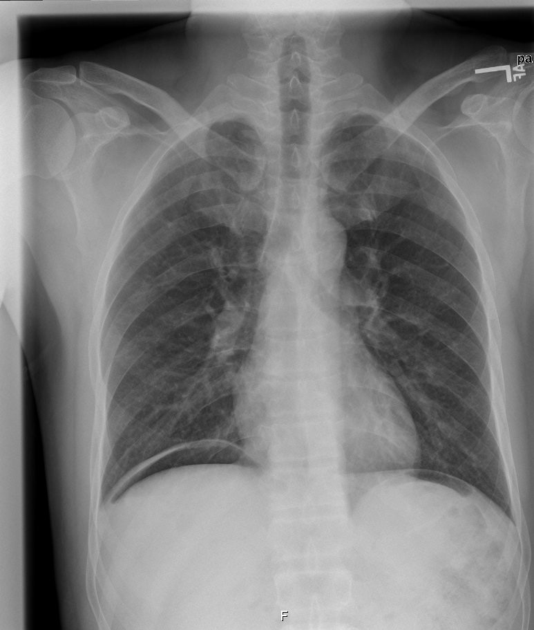 XRay Vision: So Much Abdominal Pain - County EM